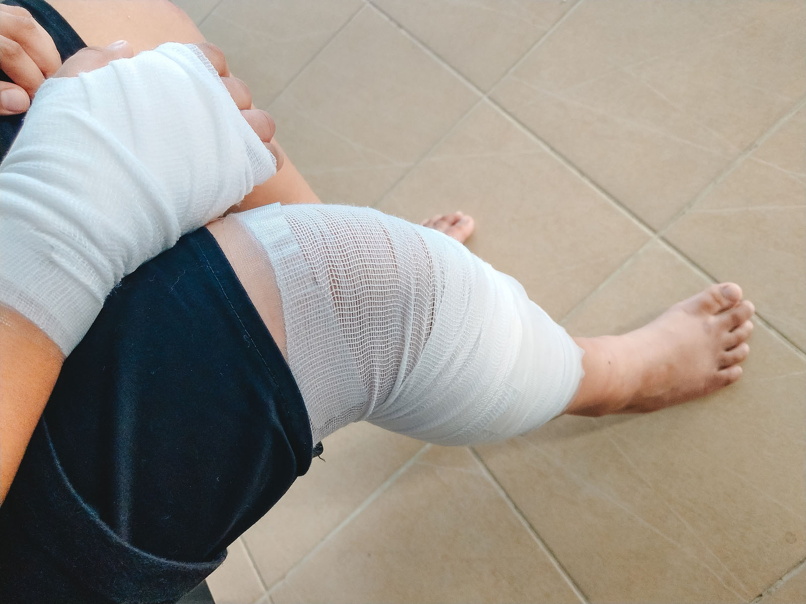 How Long Does a Personal Injury Lawsuit Take?